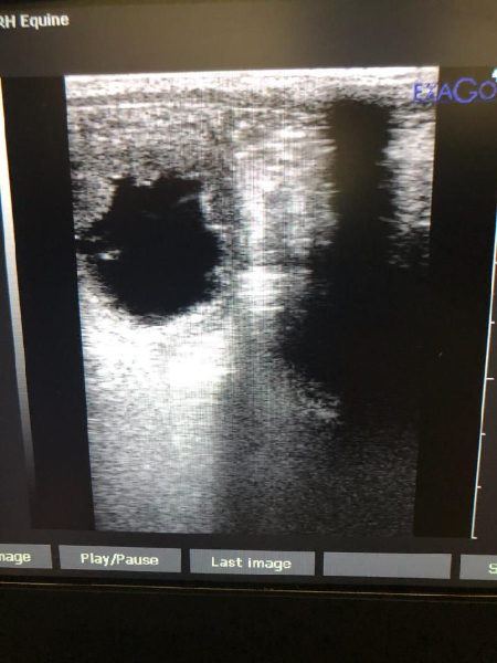  Shelly Ultrasound